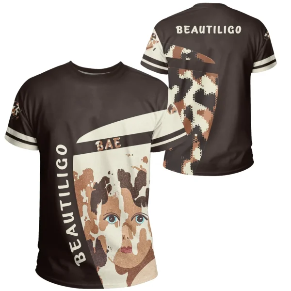 T-Shirt - Vitiligo Cloth - Beautiligo Bae Tee