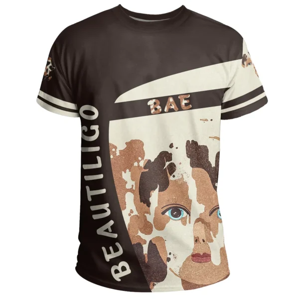 T-Shirt - Vitiligo Cloth - Beautiligo Bae Tee - Image 2